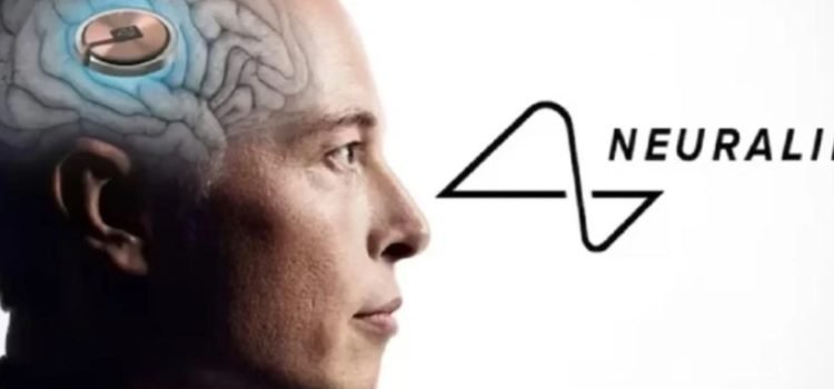 Primer paciente con chip cerebral mueve el mouse con el pensamiento Primer paciente con chip cerebral mueve el mouse con el pensamiento