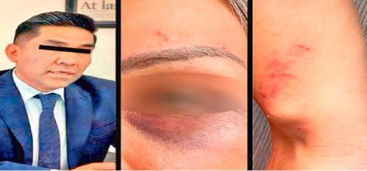 Mando policial bajo investigación por agresión a su esposa en Toluca