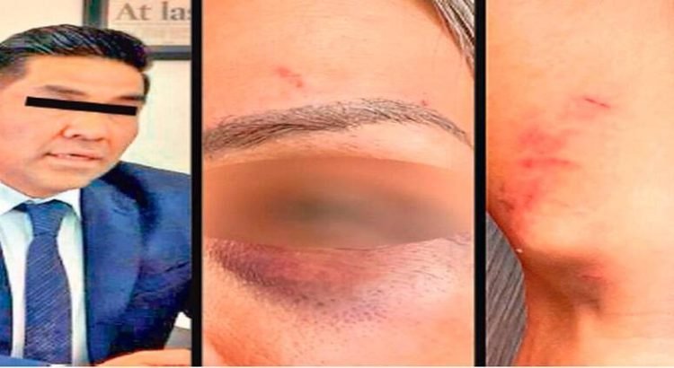 Mando policial bajo investigación por agresión a su esposa en Toluca