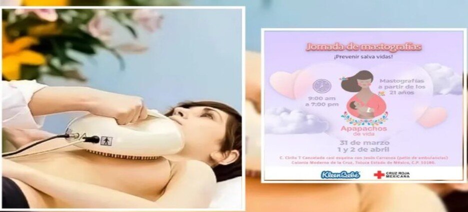 Cruz Roja realizará “mastografías sin dolor” en Toluca