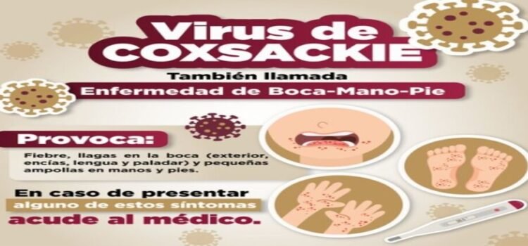 Emiten recomendaciones por virus Coxsackie en Edomex